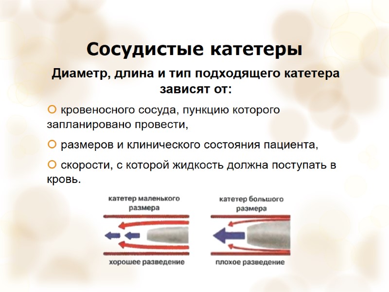 Сосудистые катетеры Диаметр, длина и тип подходящего катетера зависят от:  кровеносного сосуда, пункцию